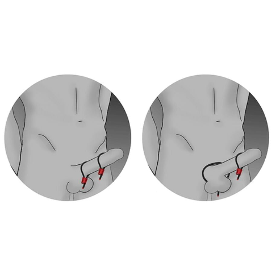 ELECTRASTIM - PRESTIGE ELECTRA LOOPS ANNEAUX PÉNIENS RÉGLABLES ROUGES ELECTRASTIM