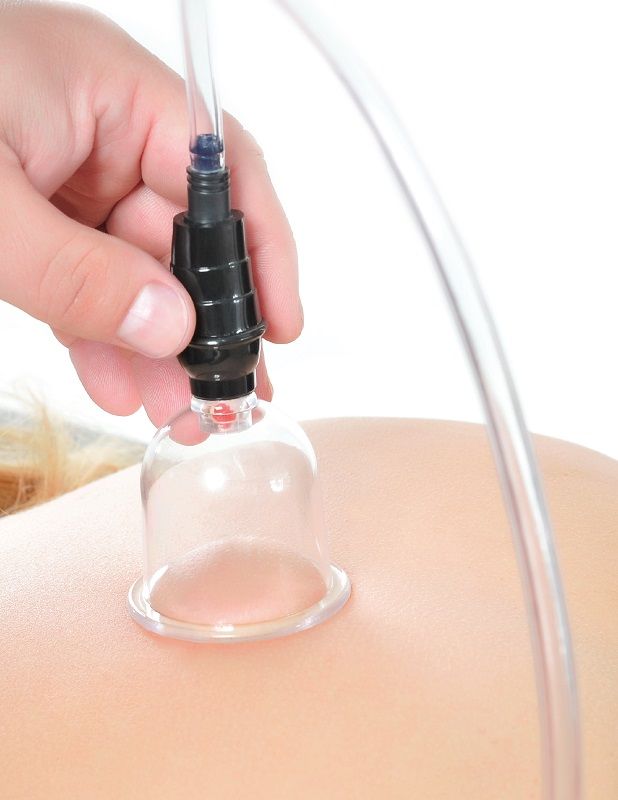 FETISH FANTASY SERIES - ENSEMBLE DE VENTOUSES 6 PIÈCES FETISH FANTASY SERIES